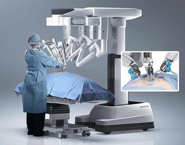 Understanding Robotic-Assisted Hysterectomy